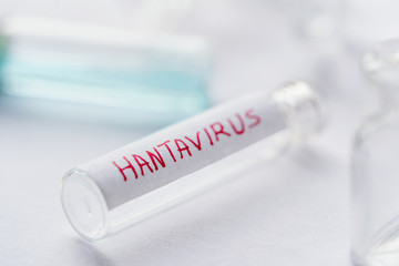 Hantavirus Background. Hantavirus lab test background. Test tube for collecting blood sample for the patients. Concept for Chinese hanta virus outbreak, medical research for cure, health risk.