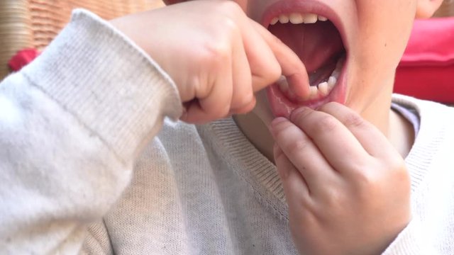 5 year old male child caucasian boy  with baby teeth is about to lose the first teetering tooth