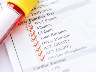 Blood sample tube with laboratory requisition form for liver function test