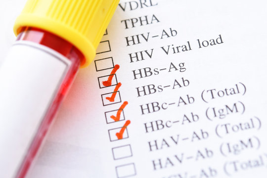 Blood sample tube with laboratory requisition form for hepatitis B virus test
