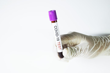 Obraz premium A doctor holding a blood tube on white background.