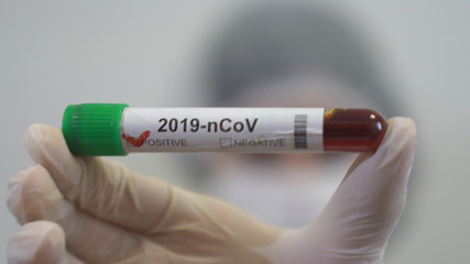 A woman doctor holds a positive coronavirus test tube in her hand. Positive covid-19 test tube. 