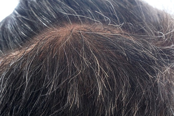  Macro gray-hair or white hoary hair on the head of old man