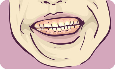Naklejka premium Symptom Teeth Grinding Illustration