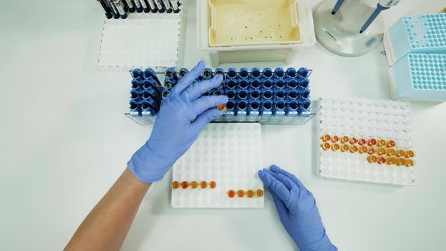 Test samples of plasma are getting put into a medical tray