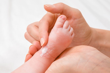 Young woman hand holding infant leg. Mother carefully applying medical ointment. Red dry skin...