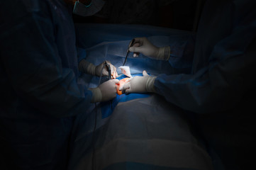 Breast tumor resection. Plastic surgery