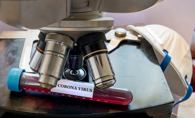 COVID-19 or CoronaVirus test tube for blood sample analyses, routine light microscope as research tool, microscopic cells testing for virus,