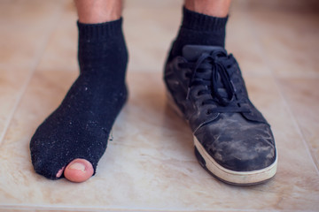 Man wearing holey sock and dirty shoes. Poorness and untidiness concept