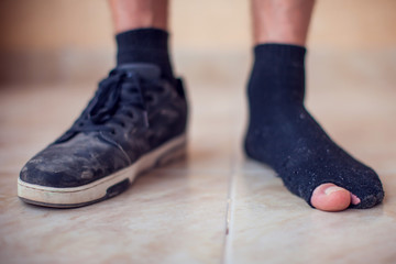Man wearing holey sock and dirty shoes. Poorness and untidiness concept