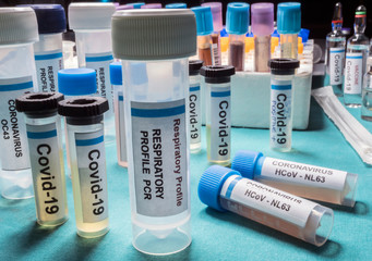 Vials containing samples from patients infected with covid19 coronavirus in a laboratory, Spain