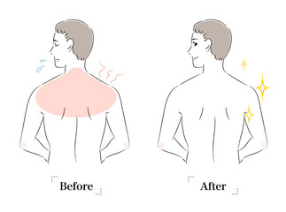 背中　肌　悩み　日焼け　ビフォーアフター　男性