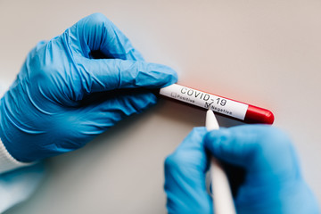 Covid-19 text. A hands of doctor, nurse, scientist writes with a pen and confirms the negative...
