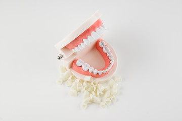 acrylic model of human jaws