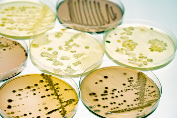 Mixed of bacteria colonies and fungus in various petri dish