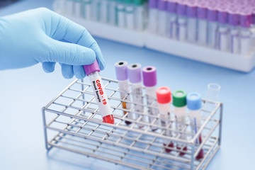 Asian male doctor holding Covid-19 or coronavirus Blood Sample on laboratory Background
