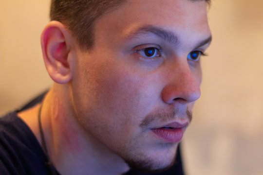 Man With Bite Mark On His Neck