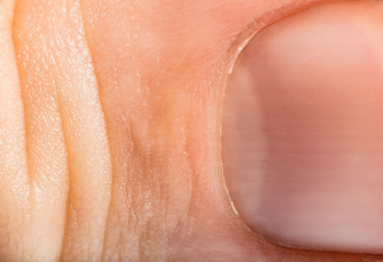 Close up human skin and claw. Macro epidermis