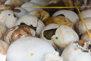 Human skulls showing head injuries