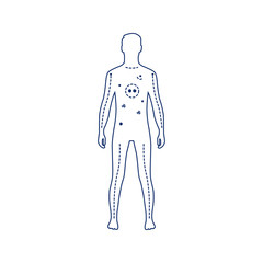 Artificial Life Support black line icon. Systems that use medical technology to aid, support, or replace a vital function of the body. Pictogram for web page, mobile app, promo. Editable stroke