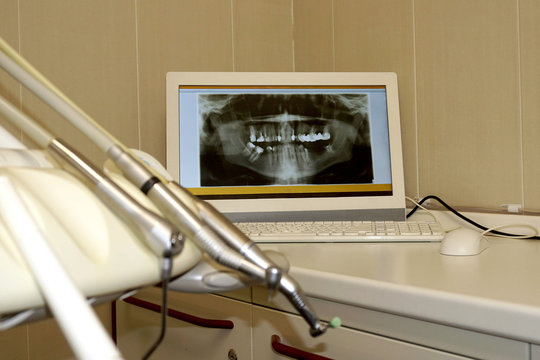 The computer screen shows a picture of the jaws and teeth on the background of the dental drill.