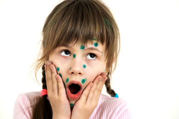 Child girl covered with green rashes on face ill with chickenpox, measles or rubella virus.