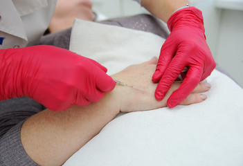 doctor cosmetologist dermatologist conducts a session of mesotherapy or biorevitalization-removal...