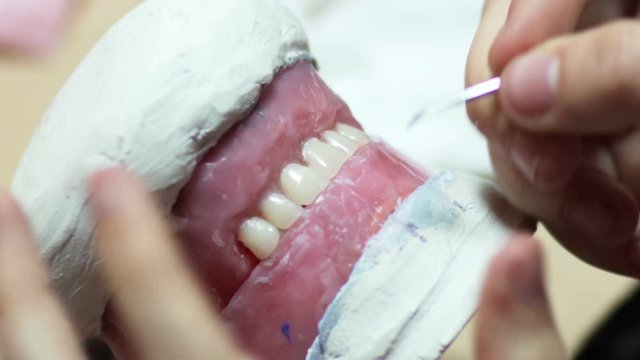 Dentist work on clayy mold human gums model in jaws prothetic laboratory, close-up