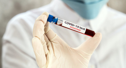 Positive COVID-19, SARS-COv2 test and laboratory sample of blood testing for diagnosis new Coronavirus infection..