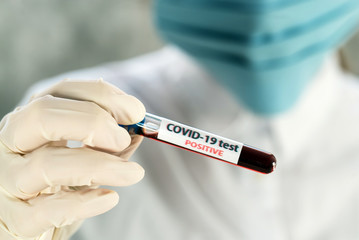 Obraz premium Positive COVID-19, SARS-COv2 test and laboratory sample of blood testing for diagnosis new Coronavirus infection..