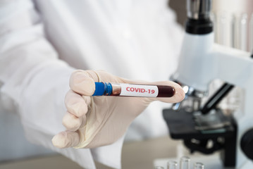 Positive COVID-19, SARS-COv2 test and laboratory sample of blood testing for diagnosis new Coronavirus infection..