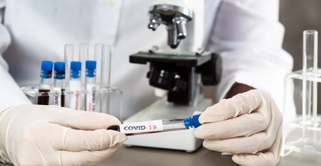 Fototapeta premium Positive COVID-19, SARS-COv2 test and laboratory sample of blood testing for diagnosis new Coronavirus infection..