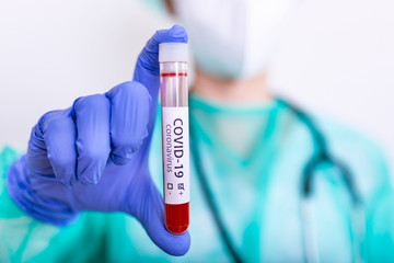 testing blood samples for the virus: the epidemiologist takes blood tests for coronavirus. epidemic...