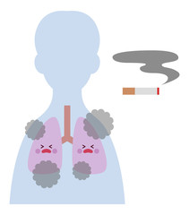 喫煙者（男性）の肺