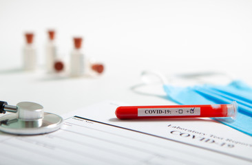 World coronavirus epidemic concept. Pandemic COVID-19, 2019-nKoV. Coronavirus vaccine testing....