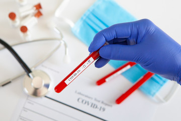 Coronavirus blood test concept. Doctor's hand in a medical glove holding a test tube with positive coronavirus blood over a laboratory desk. Coronavirus COVID-19. Pandemic.