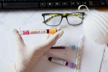 Doctor's holding the positive test result on covid-19, coronavirus