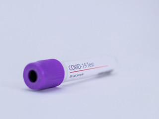 CLose up shot of an empty blood sample collection tube for Coronavirus or COVID 19 test.