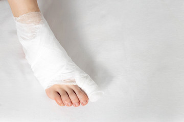 Bandaged big toe with foot on white background. Concept of fracture of the foot and thumb,...