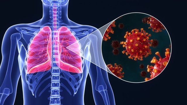 Medical animation of SARS-CoV-2 coronavirus infected lungs causing diffuculty in breathing or pneumonia or othercovid-19 related lung disease. Realistic high quality 3d medical animation. 