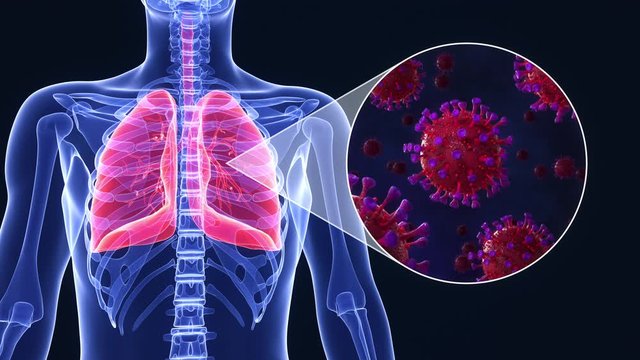 Medical animation of SARS-CoV-2 coronavirus infected lungs causing diffuculty in breathing or pneumonia or othercovid-19 related lung disease. Realistic high quality 3d medical animation. 