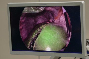 Surgeon used high technology for surgery treatment in operating room.