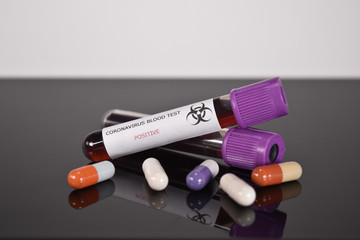 santé coronavirus covid-19 épidémie pandémie