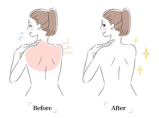 背中　肌　悩み　日焼け　ビフォーアフター　女性