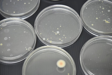 Colonies of bacteria in petri dish.