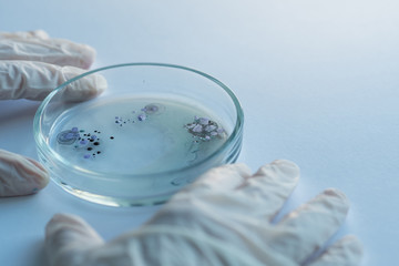 epidemic and the global virus attack concept. lab technician or researcher holds a Petri dish with a sample. Virology and bacteriology