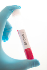 Test tube with blood sample for COVID-19 test, novel coronavirus 2019 found in Wuhan, China.