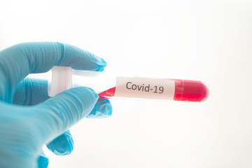 Test tube with blood sample for COVID-19 test, novel coronavirus 2019 found in Wuhan, China.