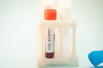Test tube with blood sample for COVID-19 test, novel coronavirus 2019 found in Wuhan, China.