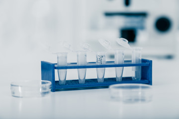 A row of pipes of scientific samples in a laboratory. Test tubes for medical chemical analysis